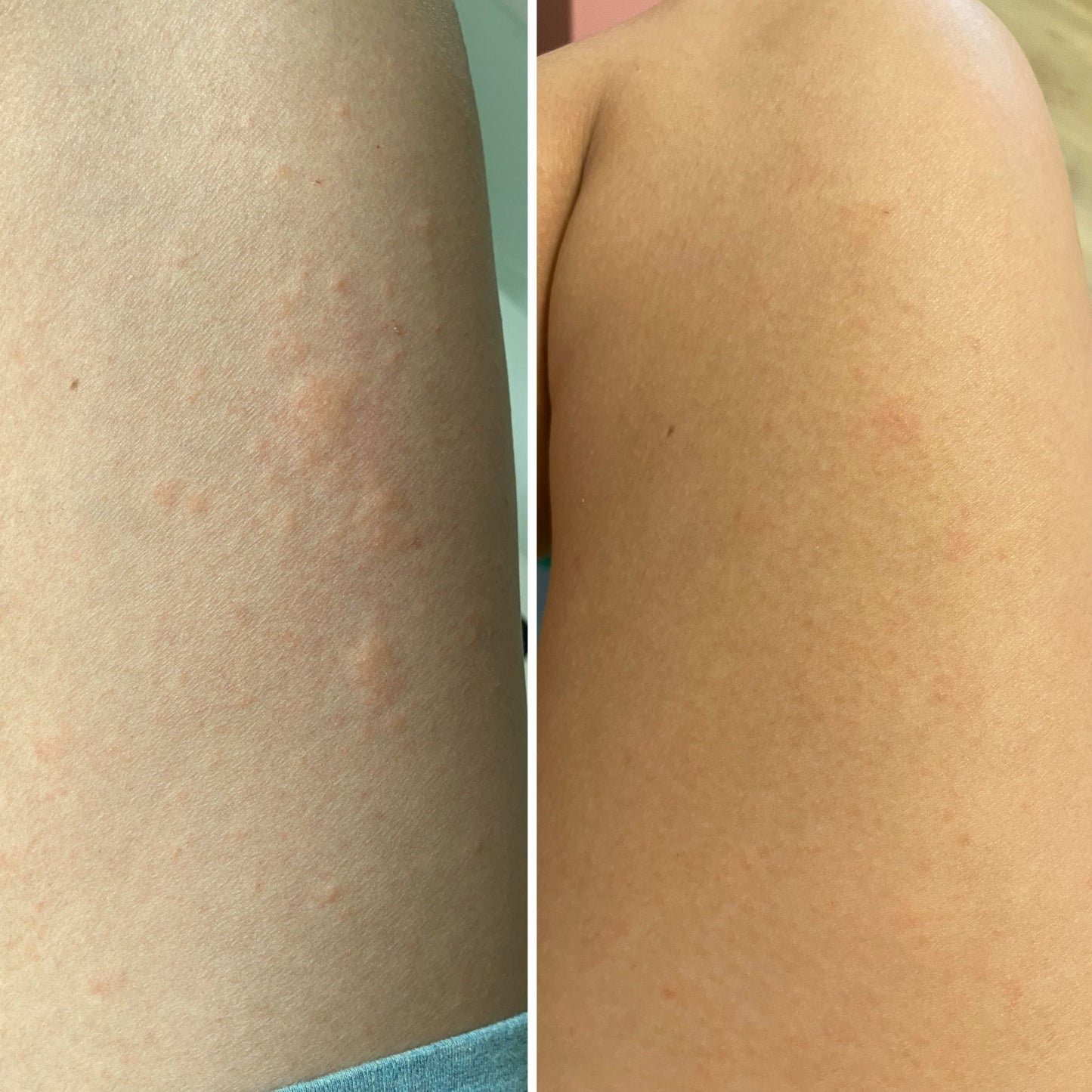 유기농 모이스쳐 힐링밤 두비두범 DooBeeDooBum™