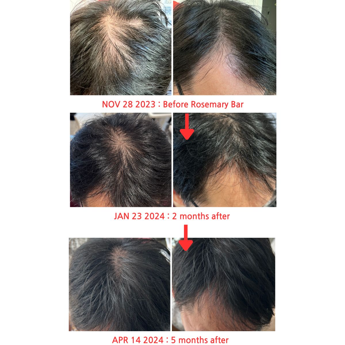 로즈마리 헤어 & 마사지 올인원 바