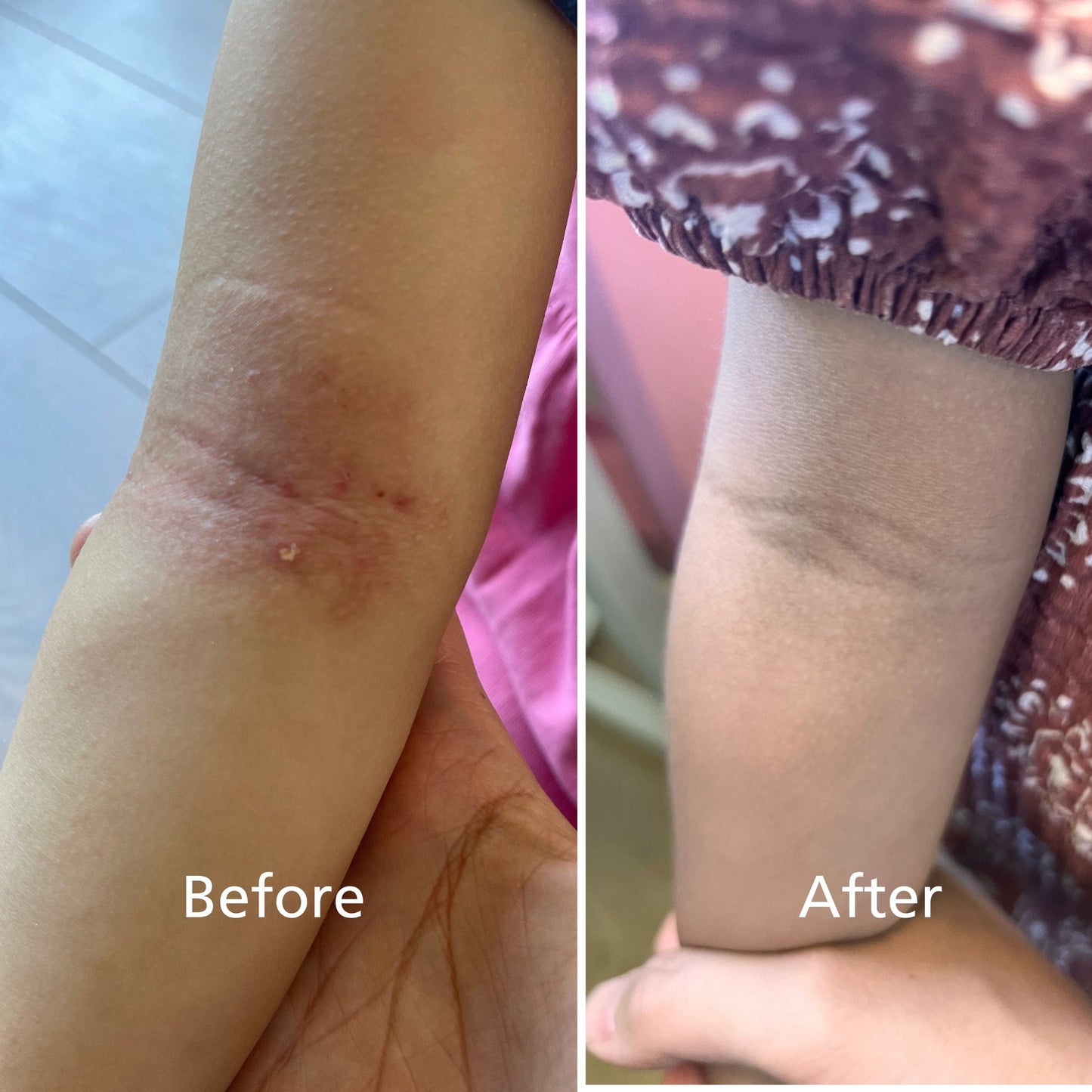 유기농 모이스쳐 힐링밤 두비두범 DooBeeDooBum™